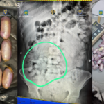 Captură de droguri pe Aeroportul Henri Coandă: Un brazilian, prins cu droguri în stomac și lipite de corp 1